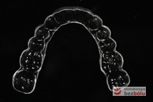Przeźroczysta szyna dopasowana do kształtów anatomicznych zębów