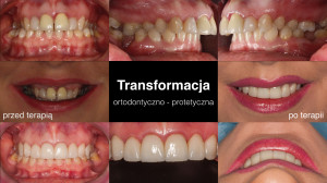 plakat_orto-protet_transform