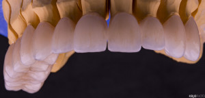 PRO-DENT-MZ-SM-praca-2