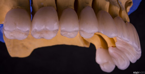 PRO-DENT-MZ-SM-praca-3