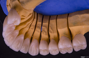 PRO-DENT-MZ-SM-praca-4