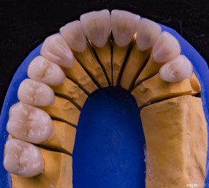 PRO-DENT-MZ-SM-praca-5