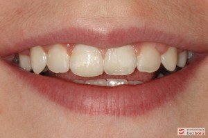 Uśmiech pacjenta po leczeniu Uśmiech pacjenta po leczeniu