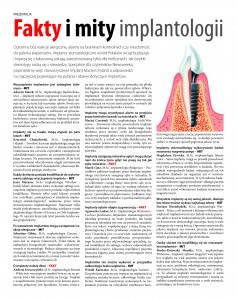 newsweek_fakty_mity_implantologii