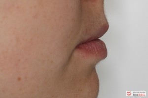 Profil pacjentki po leczeniu Profil pacjentki po leczeniu