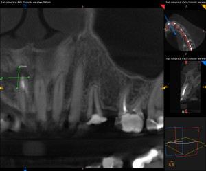 1-ScreenShot_1.2.250.1.90.3.2027043411.20170509175023.4980.32