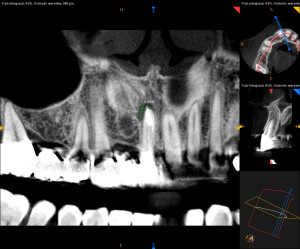 2-ScreenShot_1.2.250.1.90.3.2027043411.20180313135338.2932.32