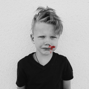 Spokój, opanowanie emocji i szybkość działania to kluczowe czynniki, wpływające na skuteczny ratunek uszkodzonego zęba!