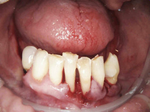 4) Zdjęcia kamerą wewnątrzustną