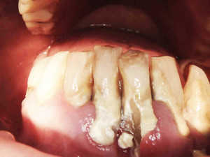 Zdjęcie kamerą wewnątrzustną