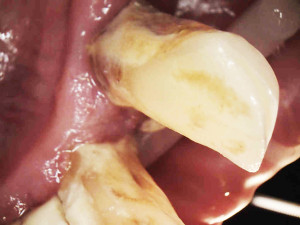 Zdjęcie kamerą wewnątrzustną