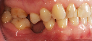 widok od str. policzkowej prawej