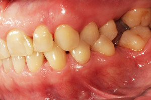 widok strony policzkowej lewej