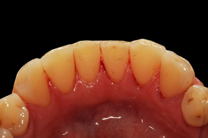 widok ze stronyjęzykowej