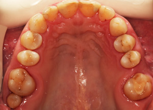widok od strony podniebiennej