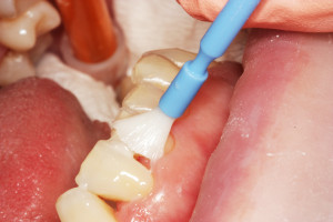 widok ze strony przedsionkowej